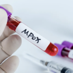 Alerta preventiva: Jalisco refuerza recomendaciones ante repunte de casos de Mpox