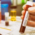 Perú confirma los primeros casos de influenza A H3N2