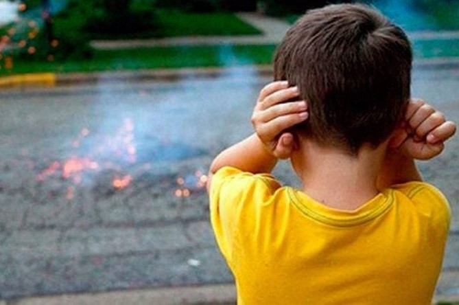 Mejoran calidad de vida de niños con secuelas de quemaduras en Guadalajara