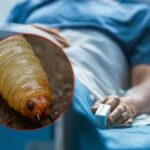 Autoridades sanitarias confirman primer caso humano de gusano barrenador en Jalisco